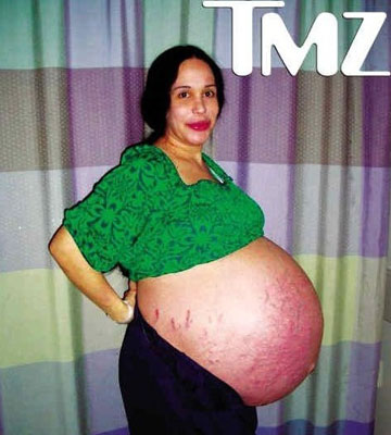 八胞胎妈妈产后身材火辣